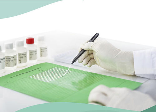 Striscia analitica per malattie autoimmuni - Shenzhen Yhlo Biotech Co., Ltd. - per malattie epatiche / del diabete / della vascularite