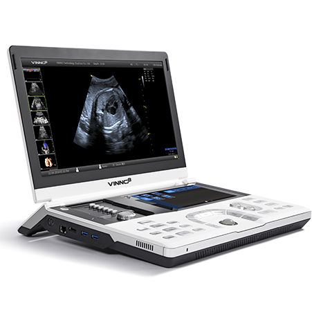 Ecografo portatile - VINNO8 - VINNO - per ecografia multidisciplinare / 3D/4D / con doppler a colori