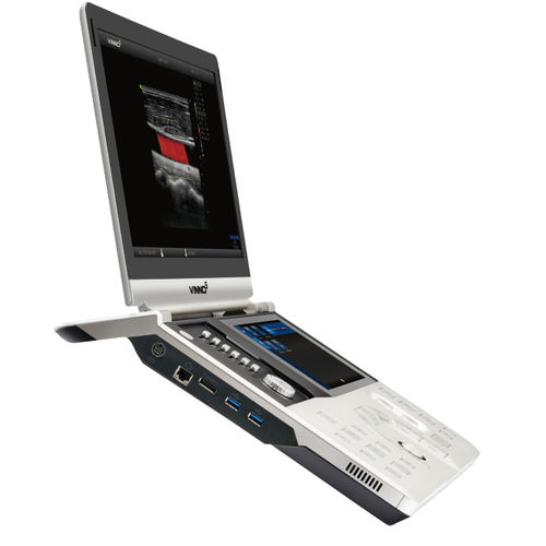 Ecografo portatile - VINNO 5 - VINNO - per ecografia ginecologica ed ostetrica / con console integrata
