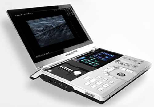 Ecografo portatile - VINNO 5 MSK  - VINNO - per ecografia muscolo-scheletrica / con console integrata