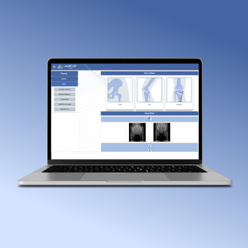 Software di gestione - medc-web-70 series - mediCAD Hectec GmbH - di pianificazione / di pianificazione preoperatoria / ortopedico