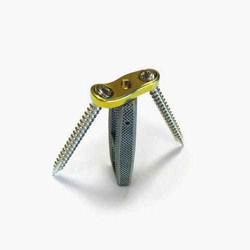 Gabbia intersomatica lombare - Idys®-LLIF 3DTi - Clariance - via laterale / in titanio / con placca ossea lombare
