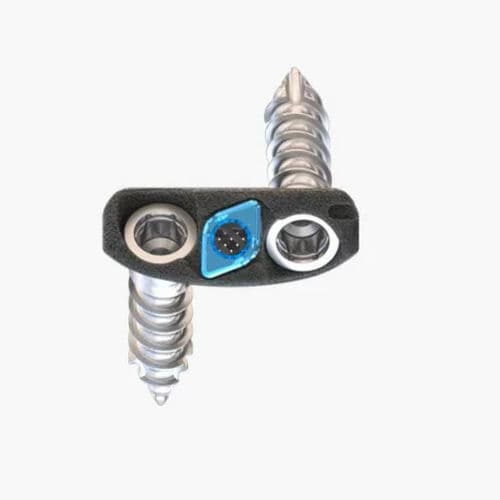 Gabbia intersomatica cervicale - Idys®-C ZP 3DTi - Clariance - via anteriore / in titanio