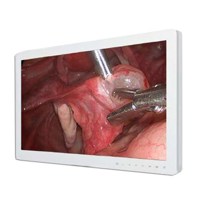Monitor medico - FS-P2607D - 3D Medi Vision - 1920 x 1080 / VGA / 26"