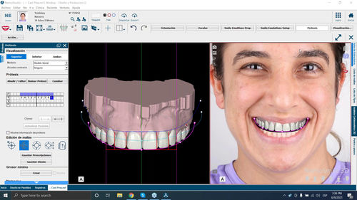 Software di progettazione digitale del sorriso - NemoSmile - Nemotec - di ottimizzazione delle immagini / di analisi delle immagini / di gestione dati dei pazienti