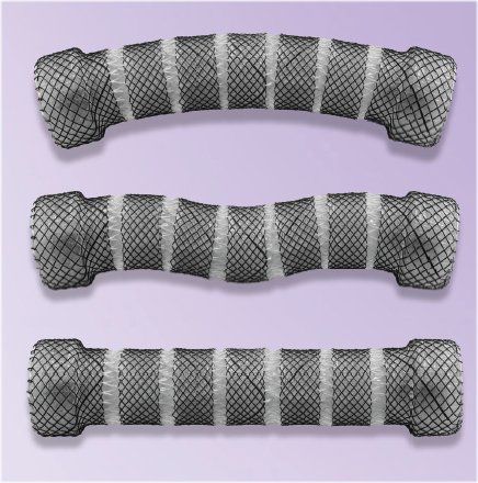 Stent esofageo - ESO-4-20-60-SEG - Creo Medical - in silicone / in nitinol / autoespandibile