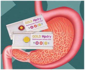 Kit di test per malattie infettive - Gold hpdry - Creo Medical - di ureasi / Helicobacter pylori / per campioni biologici