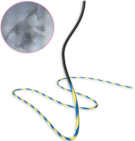 Filo guida per sonda - Rio Tracer™ - ROCAMED - ureterale / idrofilo