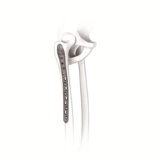 Placca di compressione per femore - 123228 series - Canwell Medical - prossimale / bloccata / in titanio