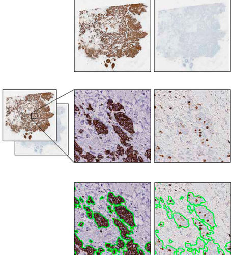 Modulo software clinico - VirtualDoubleStaining™  - Visiopharm - per laboratorio di istopatologia / di analisi delle immagini / diagnostico