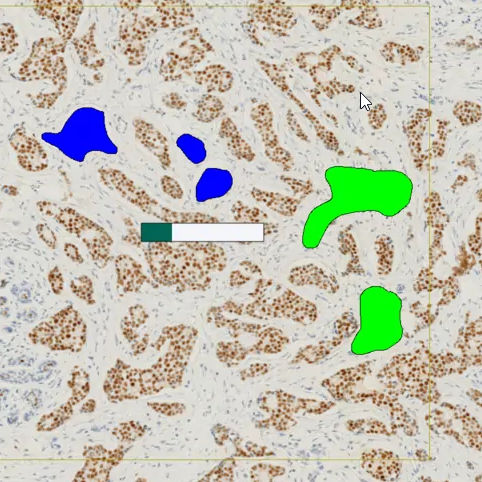 Modulo software di oncologia - ONCOTOPIX®  - Visiopharm - per immunoistochimica / per ibridazione in situ in fluorescenza / di visualizzazione
