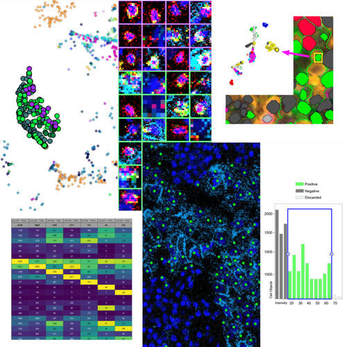 Software di analisi delle immagini - Phenoplex™ - Visiopharm - di visualizzazione / d’importazione / medico
