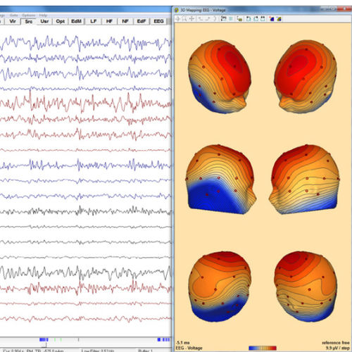 Software di analisi - Research 7.1 - BESA GmbH - di visualizzazione 3D / diagnostico / d’importazione