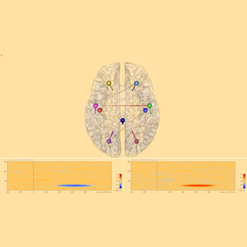 Software per EEG - Connectivity 2.0 - BESA GmbH - di analisi / di visualizzazione