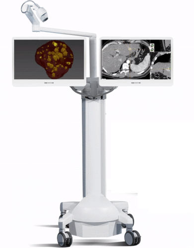 Sistema di navigazione chirurgica per radiologia interventistica - CAS-One® IR - CAScination - ottico