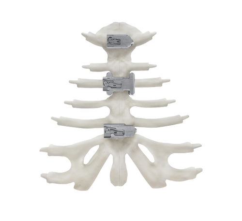 Placca di compressione per sterno - KontourTalon ® - Kontour Medical Technology - in titanio