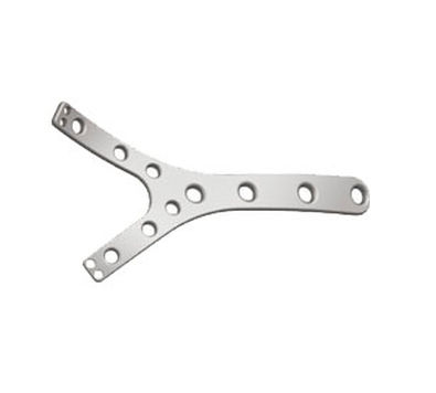 Placca di compressione per omero - Shanghai Sanyou Medical - distale / bloccata