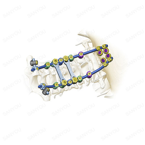Sistema di osteosintesi occipitocervicale - Cervina® - Shanghai Sanyou Medical - via posteriore / per adulti