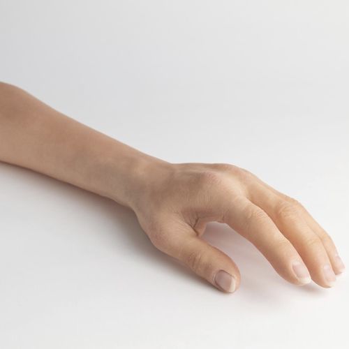 Protesi estetica per avanbraccio - schubert and braun prothesenwerk - per adulti