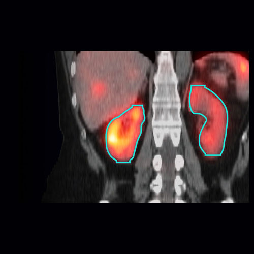 Software medico - MIM SurePlan™ MRT - Tema Sinergie - SPECT / di analisi / di visualizzazione