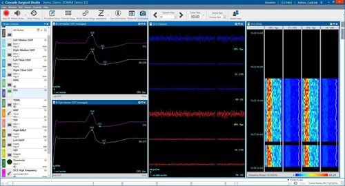 Software clinico - Cascade® - Cadwell Industries - per EEG / per EMG / chirurgico