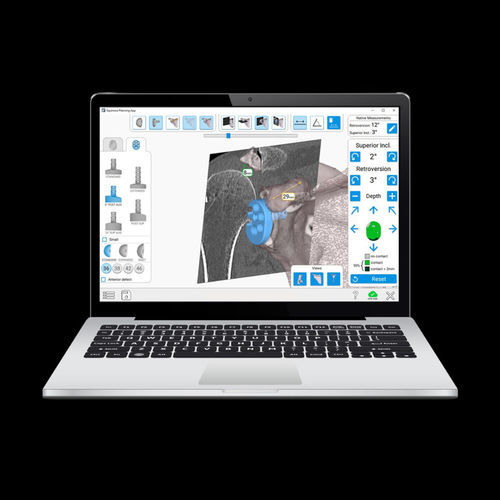 Sistema di navigazione chirurgica per artroplastica della spalla - Equinoxe®GPS® - Exactech - ottico