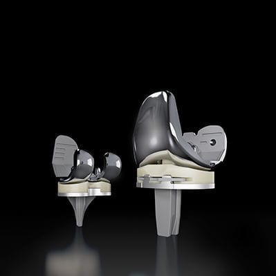 Protesi di ginocchio tricompartimentale - TriVerse™ - Exactech - a piatto fisso / cementata
