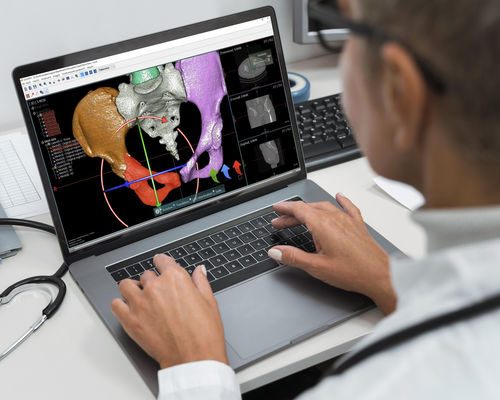 Software di pianificazione preoperatoria - OOOPDS - Taiwan Main Orthopaedic Biotechnology - di visualizzazione / di simulazione / di stampa 3D