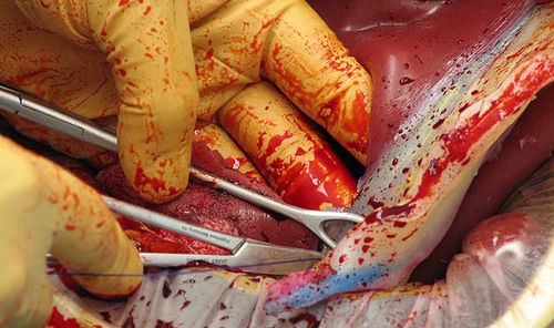 Simulatore di paziente per sutura - C-Celia   - Operative Experience Inc. - per interventi di emergenza / per chirurgia / ostetrico/ginecologico