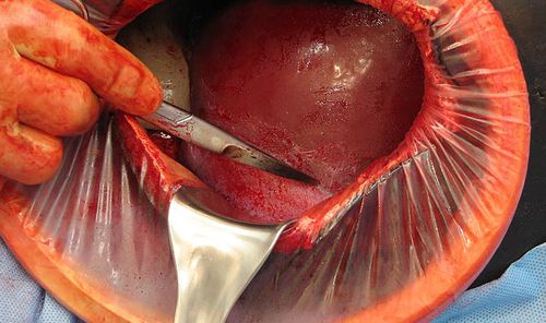 Simulatore di paziente di parto - C-Celia C-SECTION - Operative Experience Inc. - per interventi di emergenza / per chirurgia / ostetrico/ginecologico