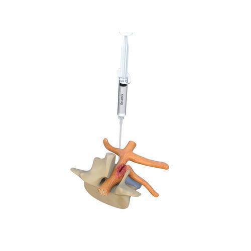 Barriera antiaderenza in gel - BETAMIX - Betatech Medical - per laparatomia addominale / per laparatomia pelvica / per cesario