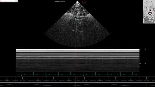 Modulo software per ecocardiografia - Pathology Module 6 - Inventive Medical Limited - di valutazione