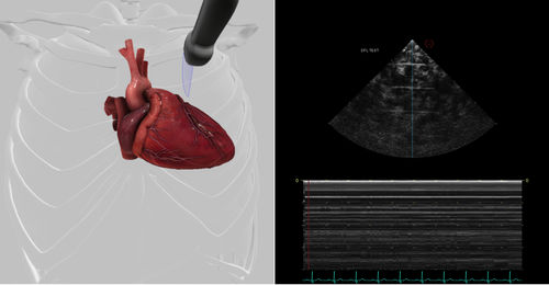 Modulo software per ecocardiografia - Pathology Module 7 - Inventive Medical Limited - di valutazione