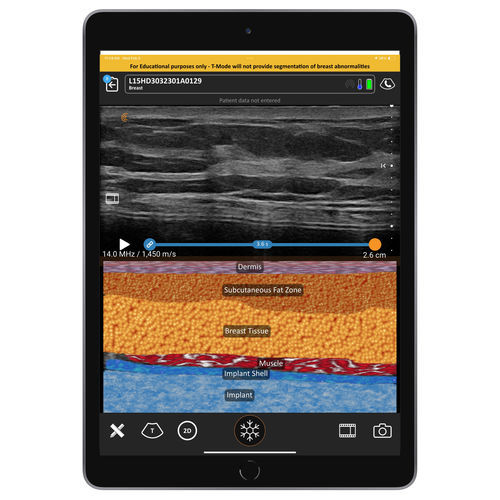 Software per ecografia - T-Mode  - Clarius Mobile Health - di visualizzazione / medico