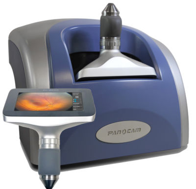 Telecamera retinica - PanoCam™Solo  - Visunex Medical Systems - palmare