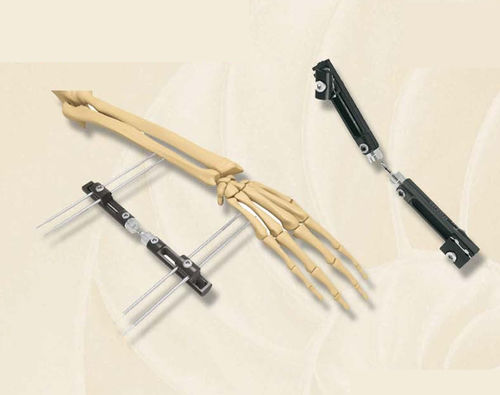 Fissatore esterno per polso - 406400 series - Biotech Medical - tubolare / per adulti
