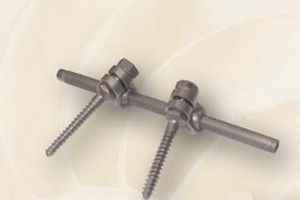 Sistema di osteosintesi toraco-lombo-sacrale - DLC - Biotech Medical - via posteriore / per adulti