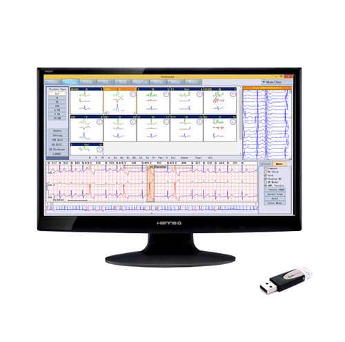 Software di gestione - BORSAM Biomedical Instrument - di analisi / per reportistica / di masterizzazione
