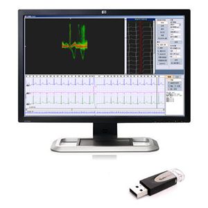 Software per ECG - iTengo+  - BORSAM Biomedical Instrument - per ospedale / per reportistica / di analisi