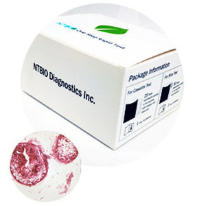 Test rapido per FOB - N040 series - NTBIO Diagnostics - oncologico / di oncologia / di marcatori tumorali