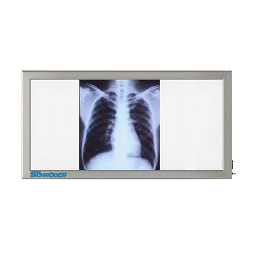 Negativoscopio 3 corpi - NT 130 - SCHRODER HEALTH PROJECTS - a luce bianca