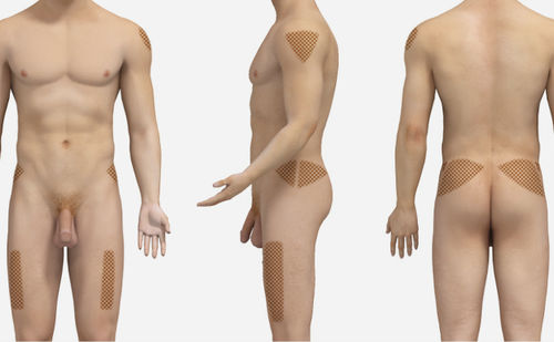 Modulo di simulazione per iniezioni intramuscolari - SIMTICS - per assistenza generale / basato sul web