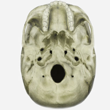Modulo di simulazione per radiografia - SIMTICS - di anatomia / con aneurisma cerebrale / basato sul web