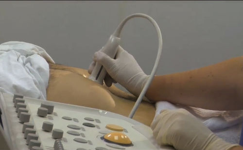 Modulo di simulazione per ecografia - SIMTICS - per colangiopancreatografia endoscopica retrograda / di anatomia / basato sul web