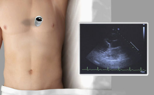 Modulo di simulazione per ecocardiografia - SIMTICS - di anatomia / basato sul web