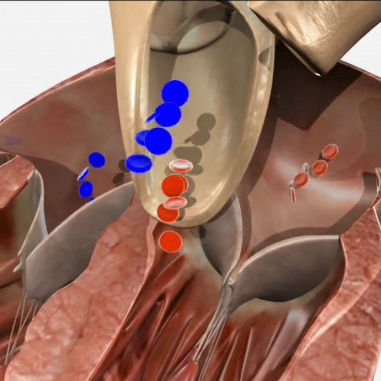 Modulo di simulazione per ecocardiografia - SIMTICS - di anatomia / per valvuloplastica / basato sul web
