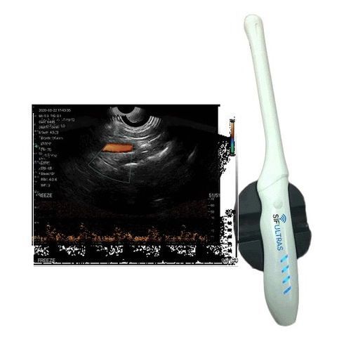 Ecografo portatile - SIFULTRAS-6.36 - SIFSOF - per ecografia endovaginale / con doppler a colori / in bianco e nero