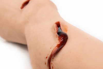 Manichino didattico per assistenza generale - MEDICAL-X - con trauma / di gamba / in plastica