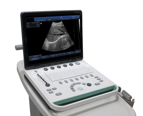 Ecografo portatile con carrello - DP-50  - Promed Technology - per ecografia ginecologica ed ostetrica / per ecografia addomino-pelvica / per ecografia urologica