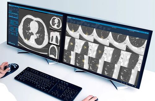 Software medico - Veolity - VAREX Imaging - per radiografia / di analisi delle immagini / di gestione